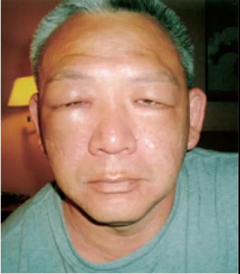 《揭开真相》（十）果然成了大头将军